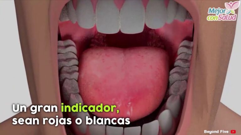 Sabor met&aacute;lico en la boca: &iquest;Un indicio temprano de c&aacute;ncer?