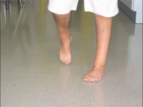 Descubre c&oacute;mo superar las barreras y levantar el pie hacia arriba: &iexcl;la clave del &eacute;xito!