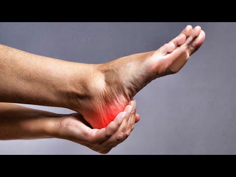 Secretos para curar &iexcl;adi&oacute;s al dolor de talones!