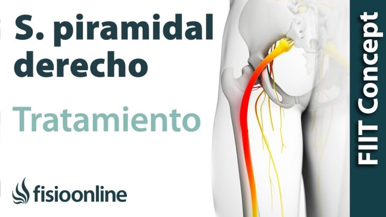 Aliviando el dolor en el piramidal derecho: el secreto para una espalda saludable