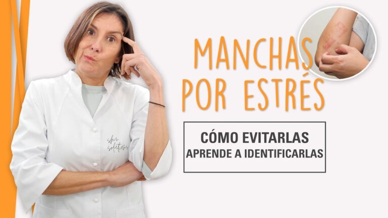 Descubre c&oacute;mo el estr&eacute;s desencadena manchas rojas en la cara