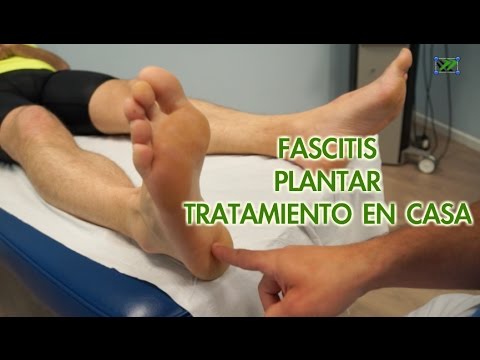 Descubre el efectivo tratamiento para curar la fascitis plantar