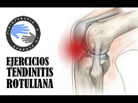 Recupera tu tend&oacute;n rotuliano con estos ejercicios