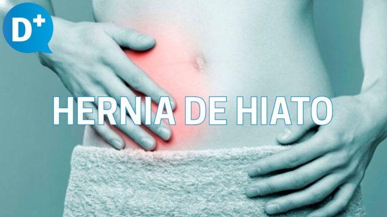 Descubre cómo tratar la hernia de hiato y decir adiós al molesto bulto