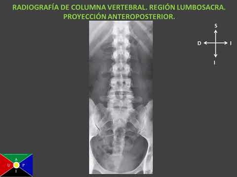 Descubre cómo mantener una columna vertebral sana con radiografías
